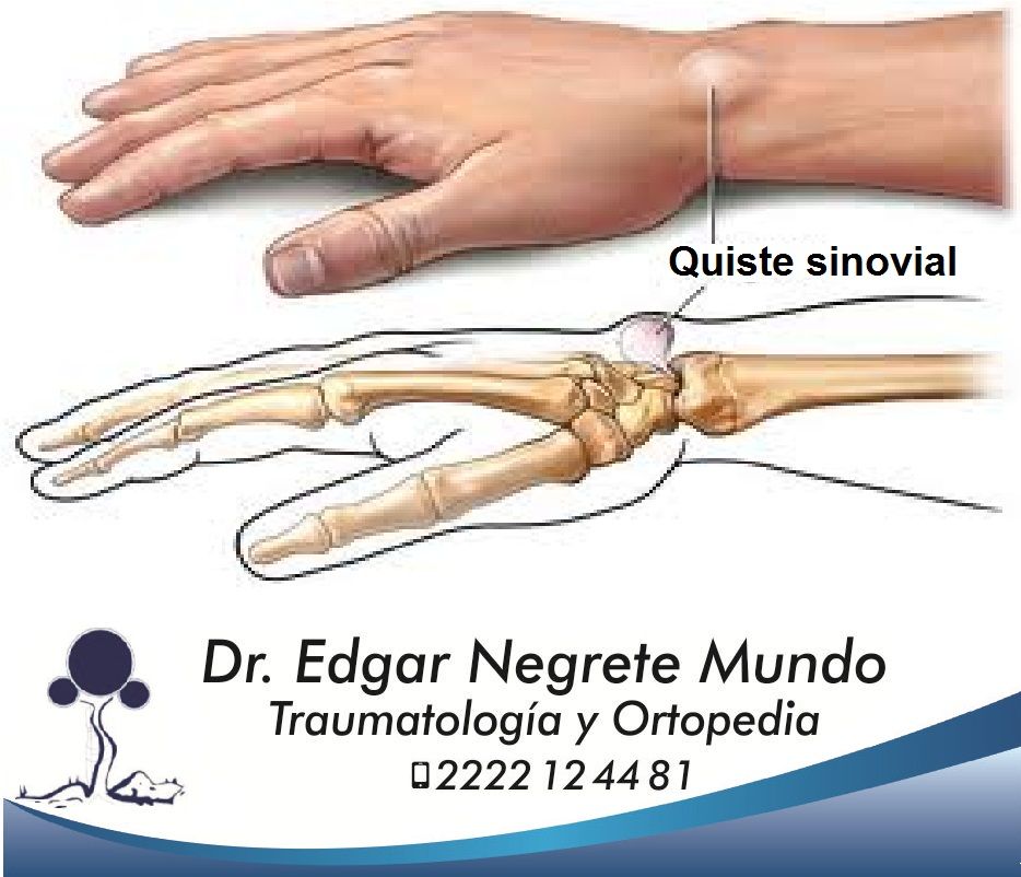 Edgar Negrete Mundo-8