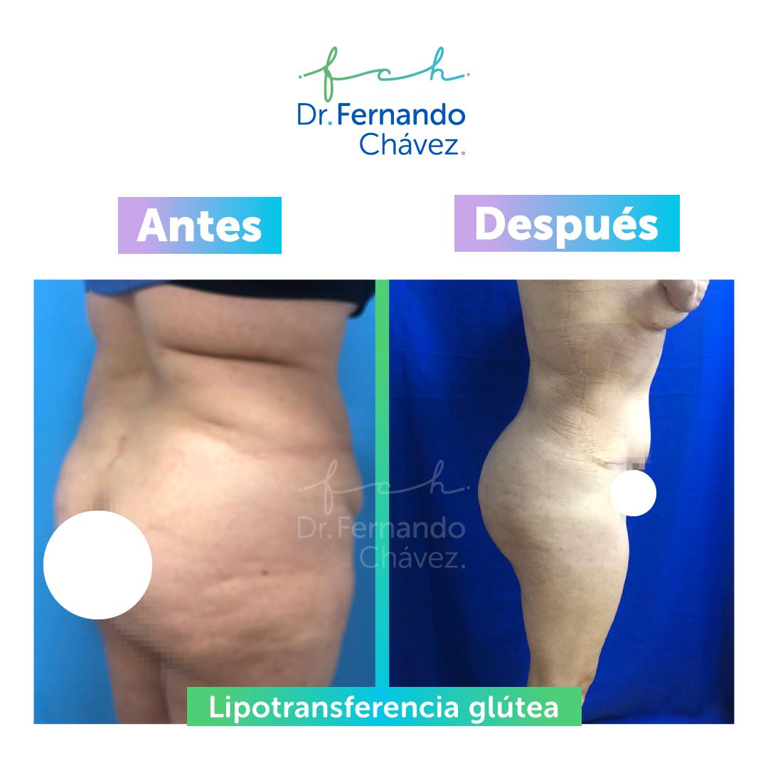 Fernando Chávez Osorio-10