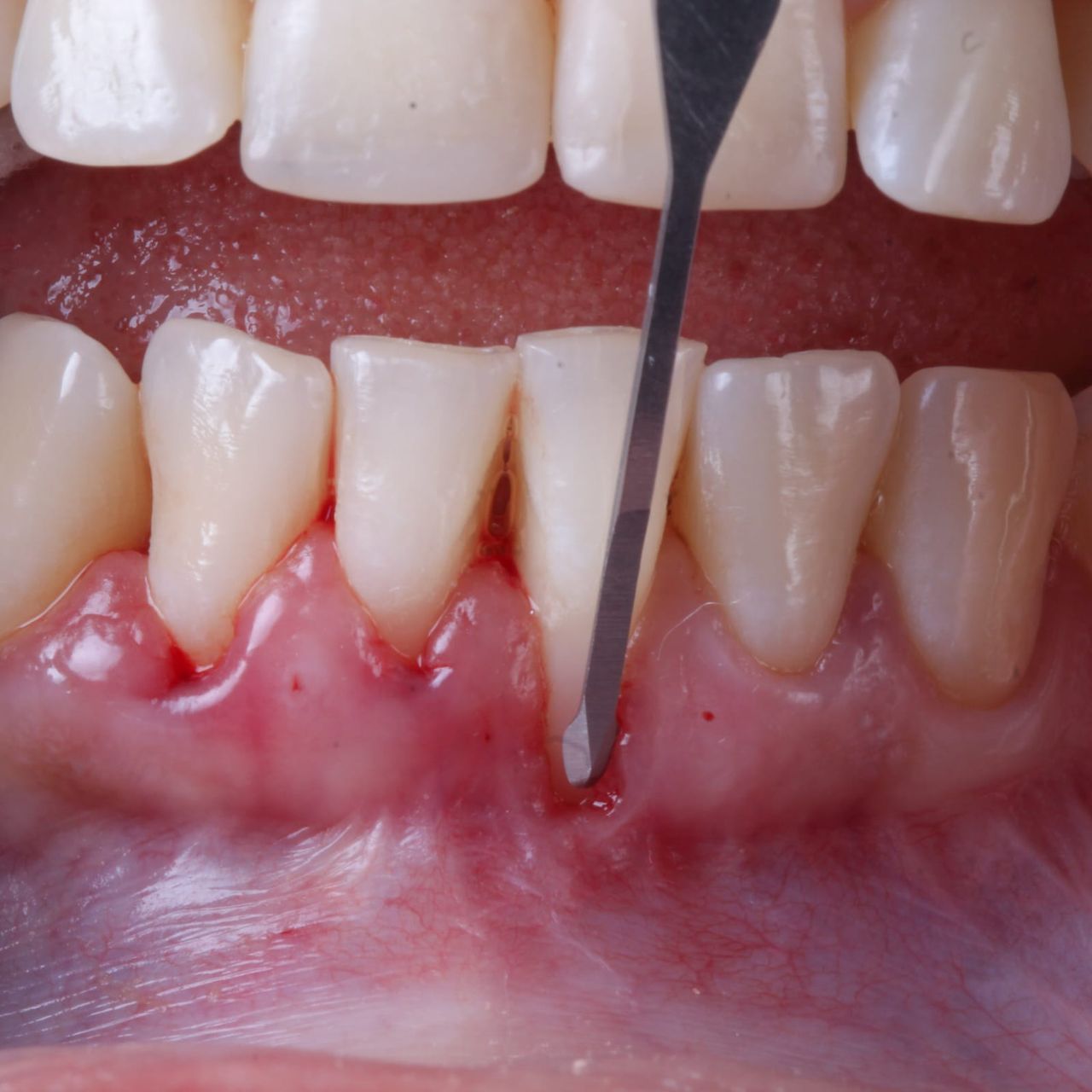 Hugo Enrique Aguilar Lamas-41