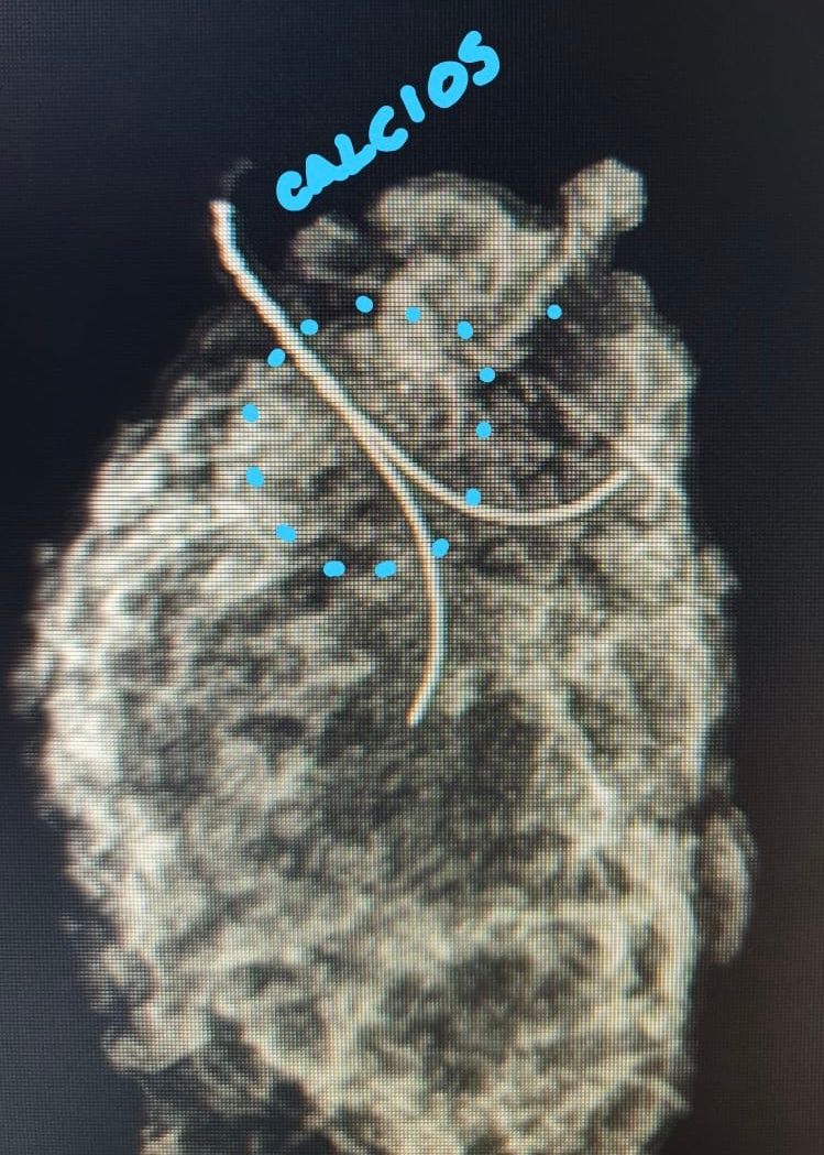 Ángel Millán Juárez-56