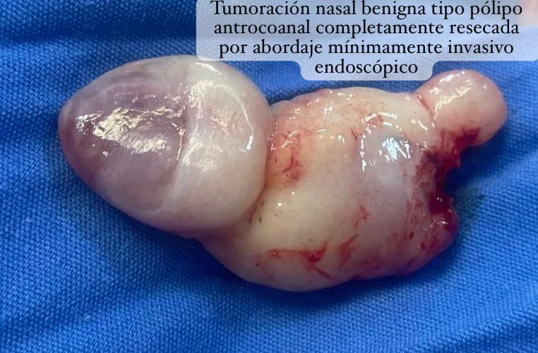 Nuria Esperanza Boronat Echeverria-20