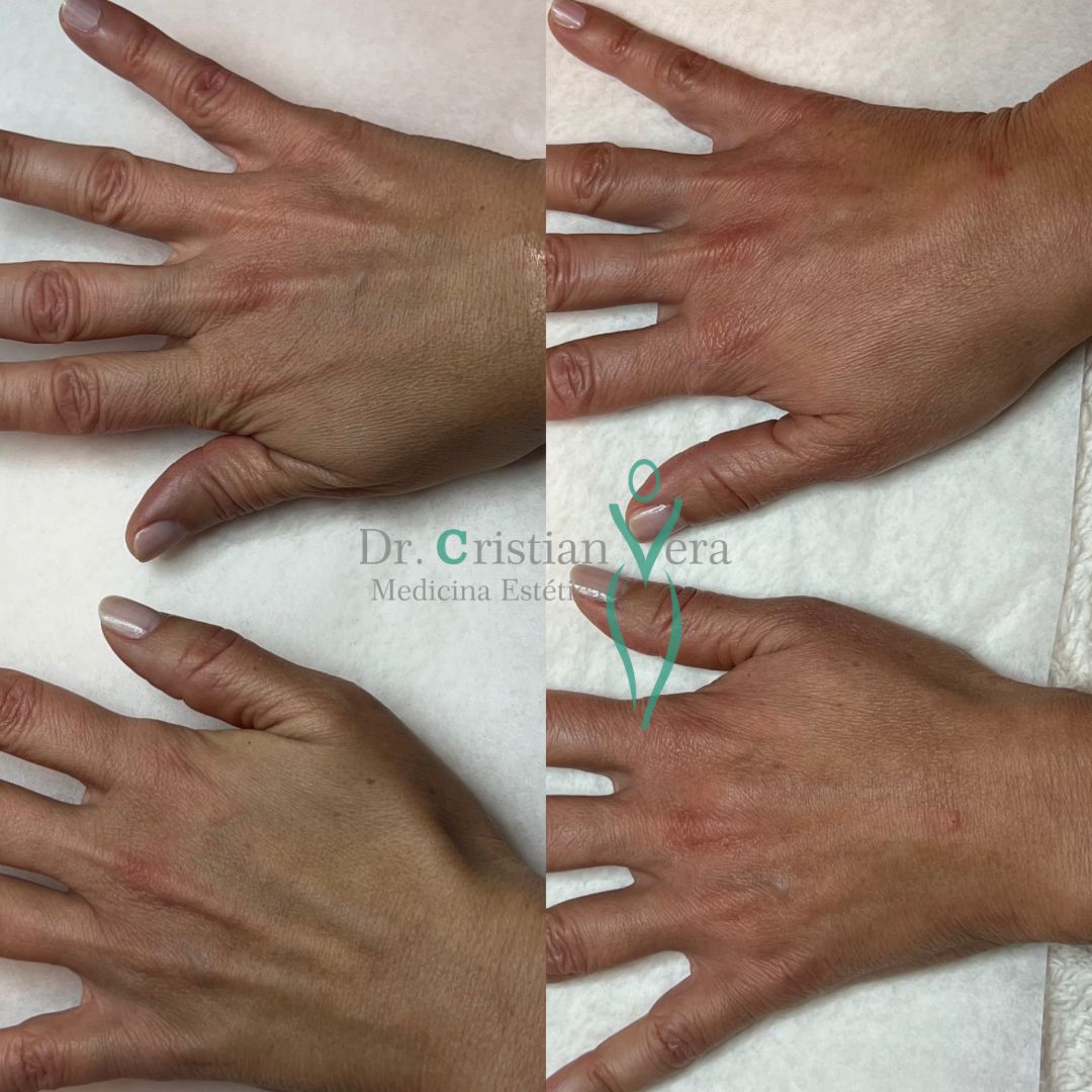 Cristian Eduardo Vera Nuño-12