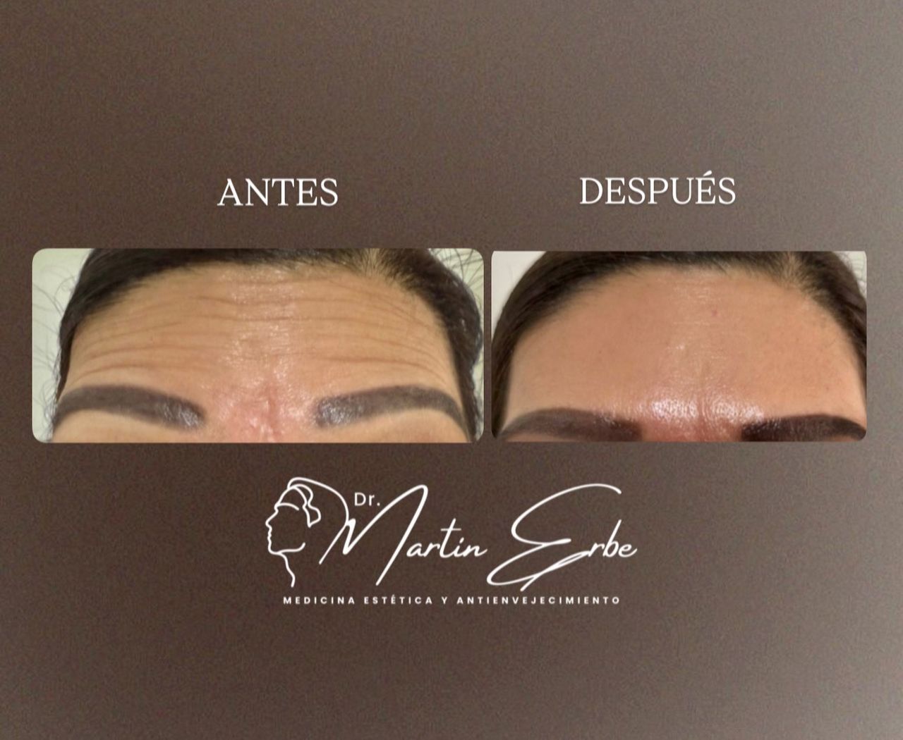 Martin Medina Erbe-14