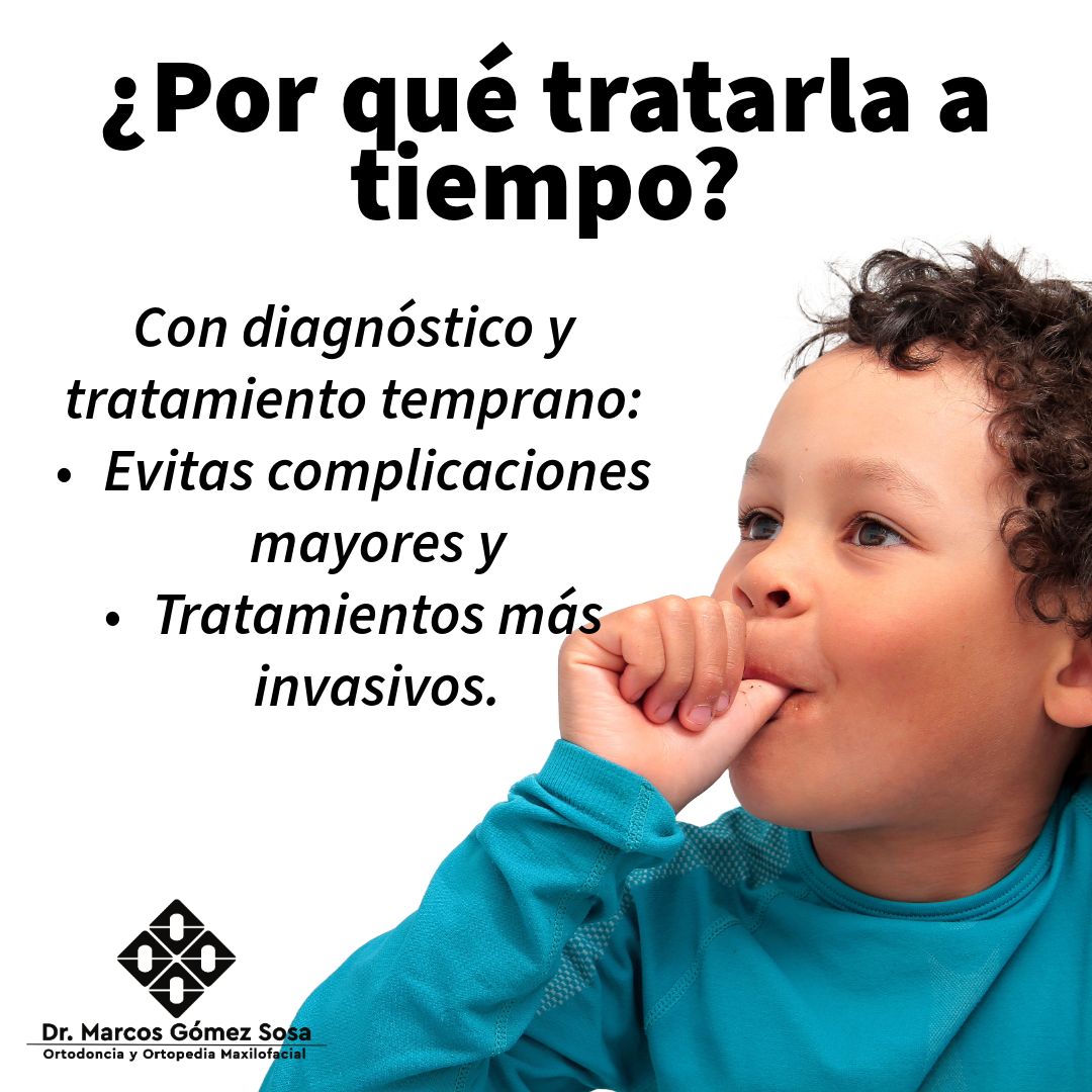 Marcos Gómez Sosa-48