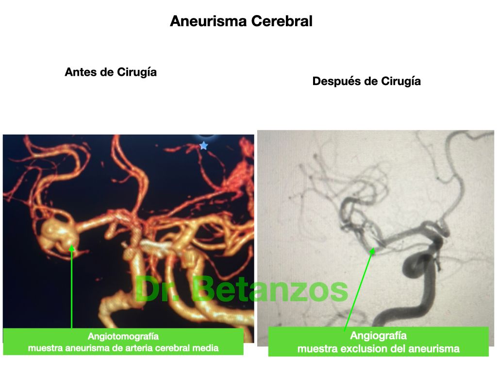 Aleixandre Betanzos Villegas-3