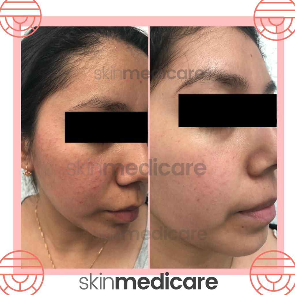 Maria Angelina Borraz Noriega-17