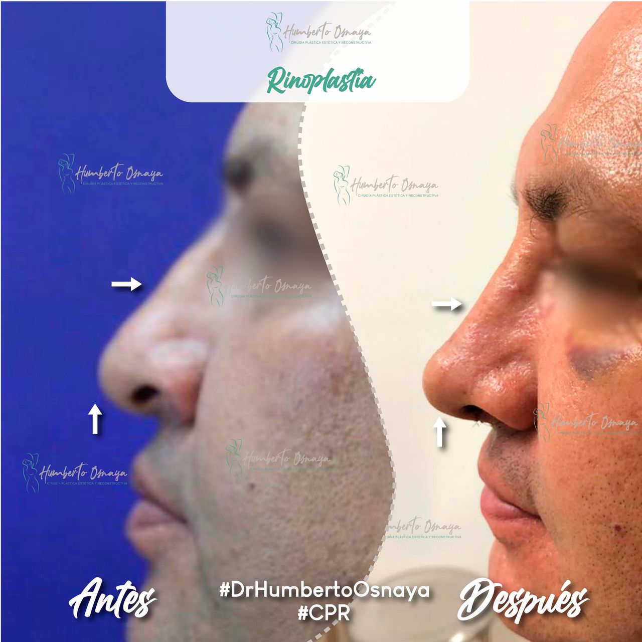 Humberto Osnaya Moreno-32