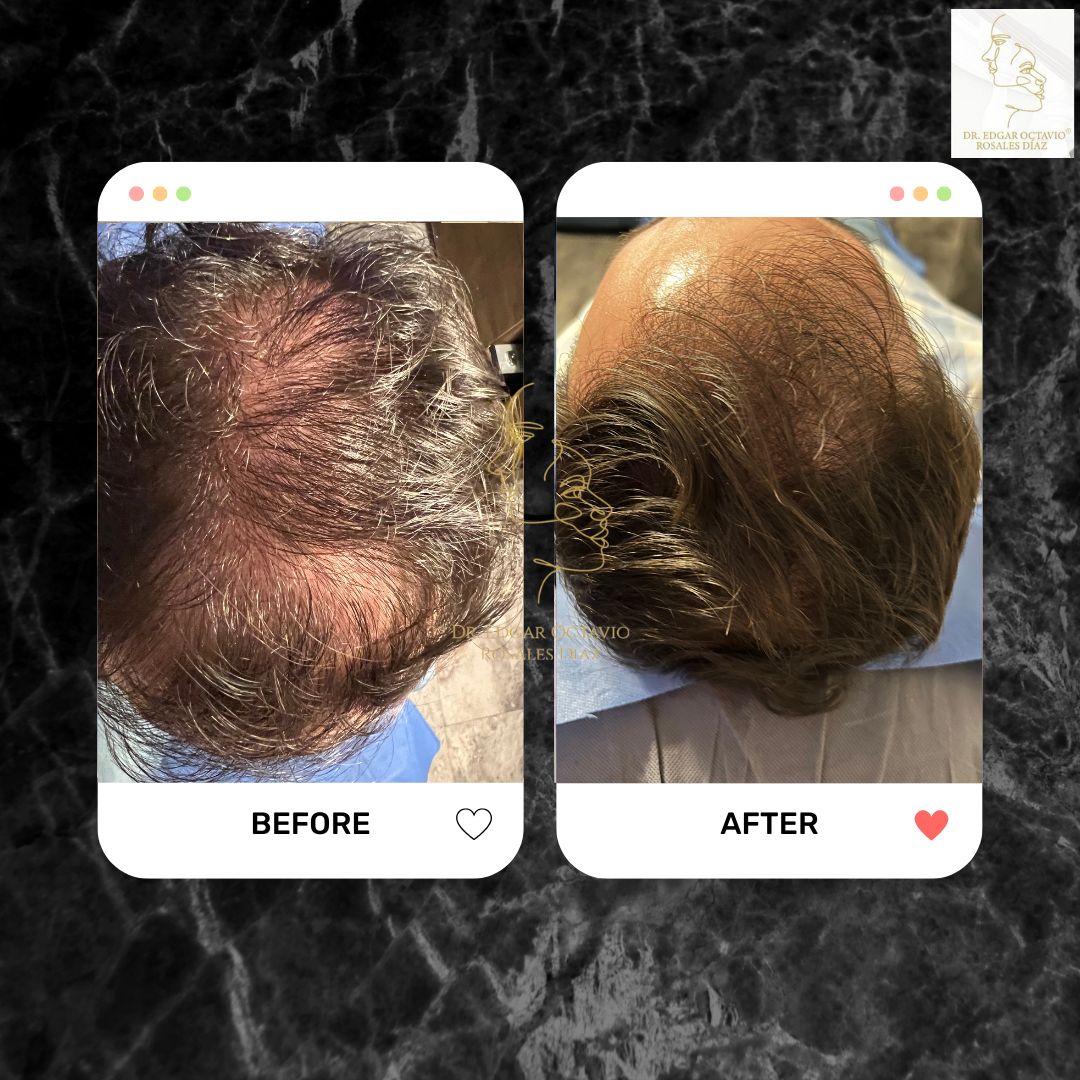 Edgar Octavio Rosales Diaz-7