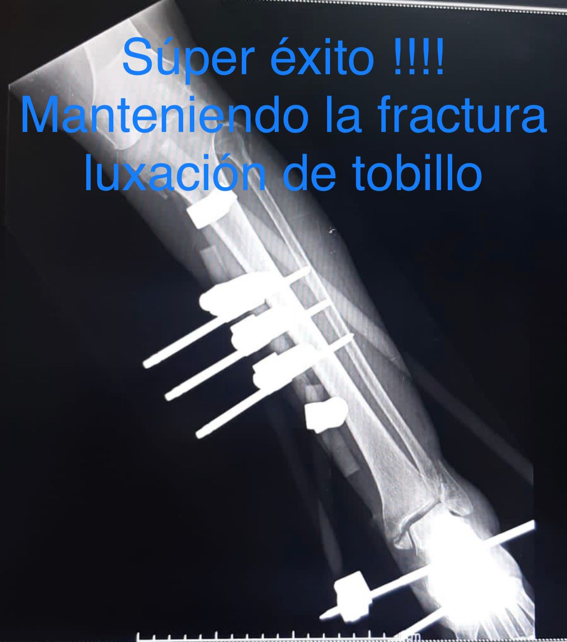 Emmanuel Bolaños Cortes-21