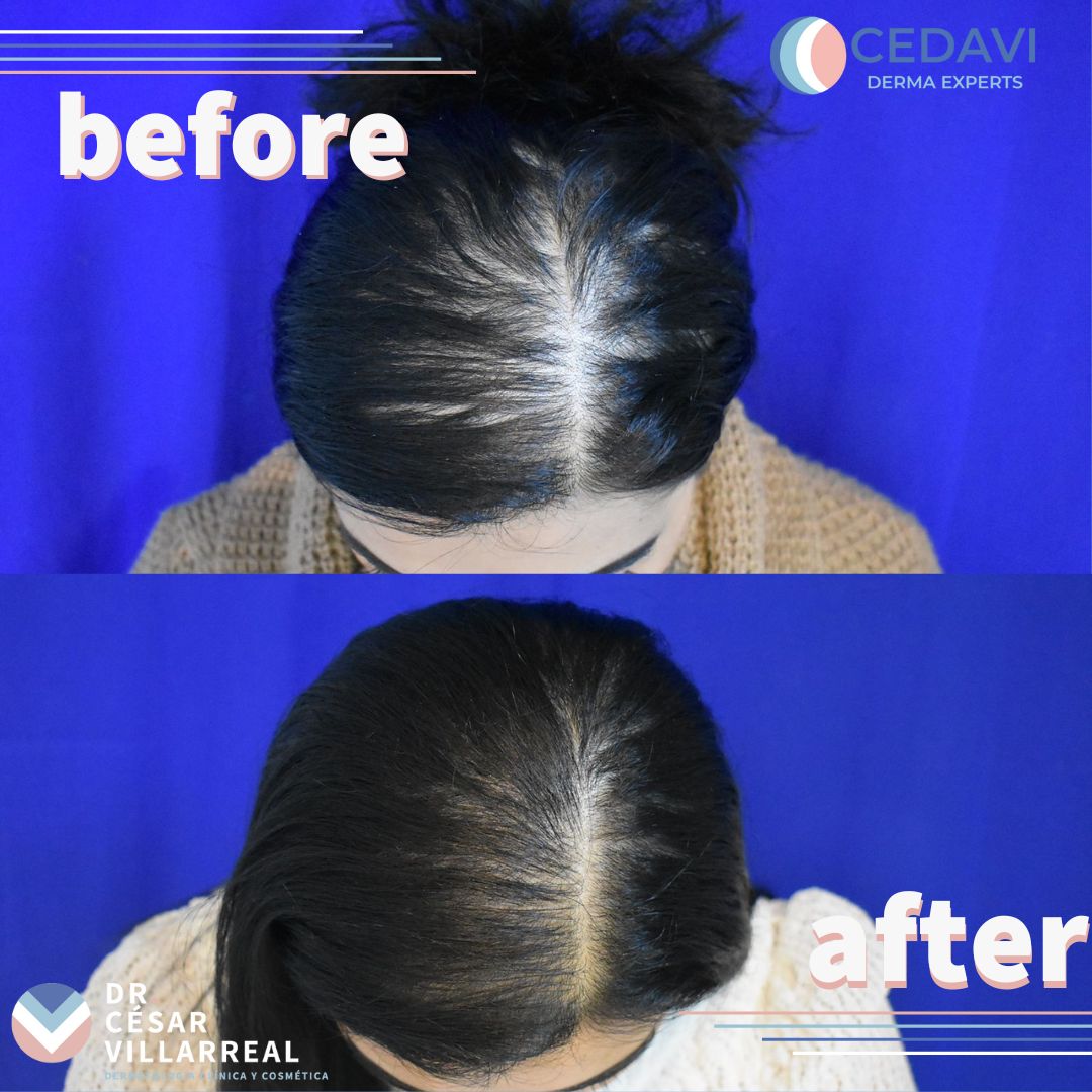 César Daniel Villarreal Villarreal-27