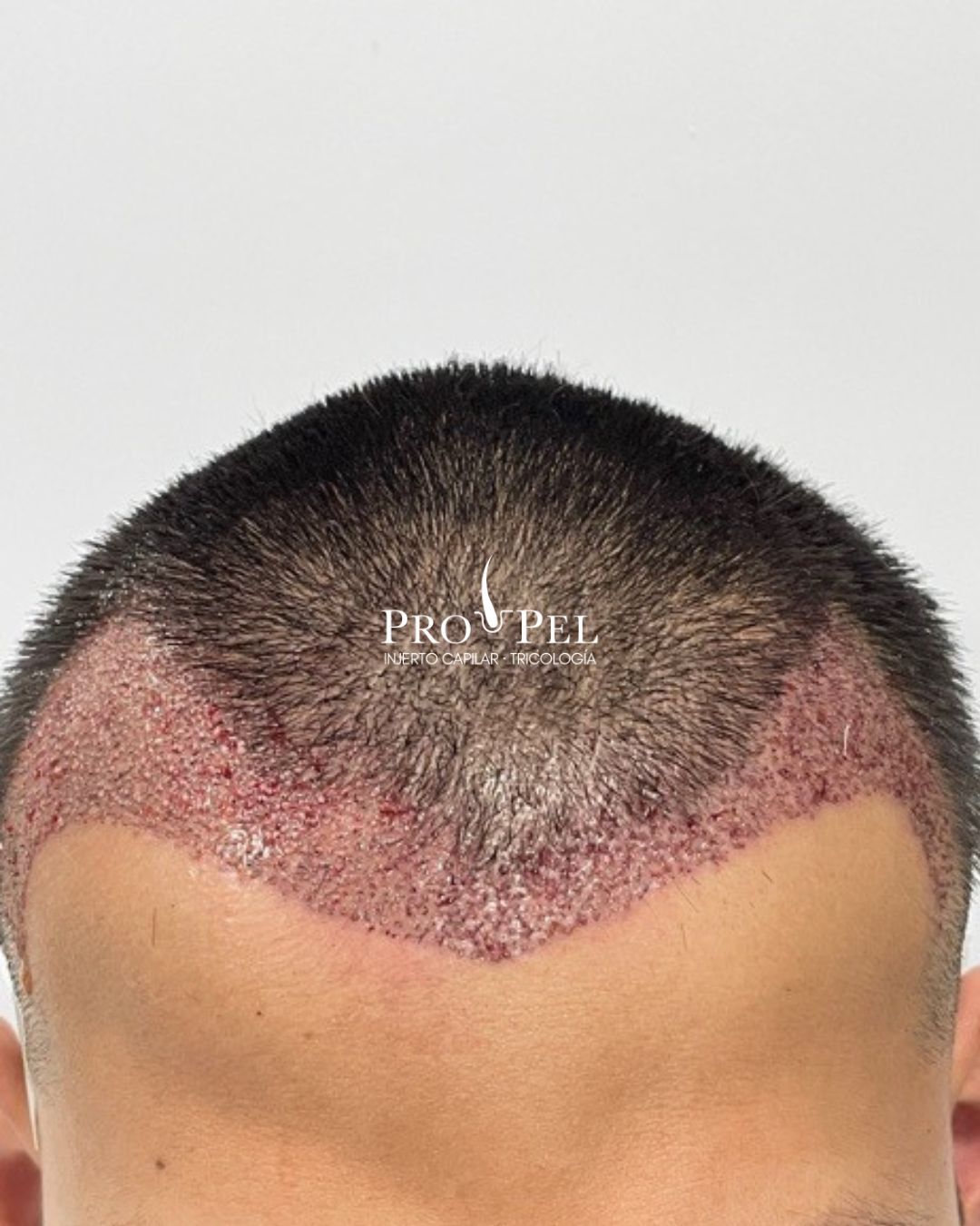 Karla Vanessa Becerra-24