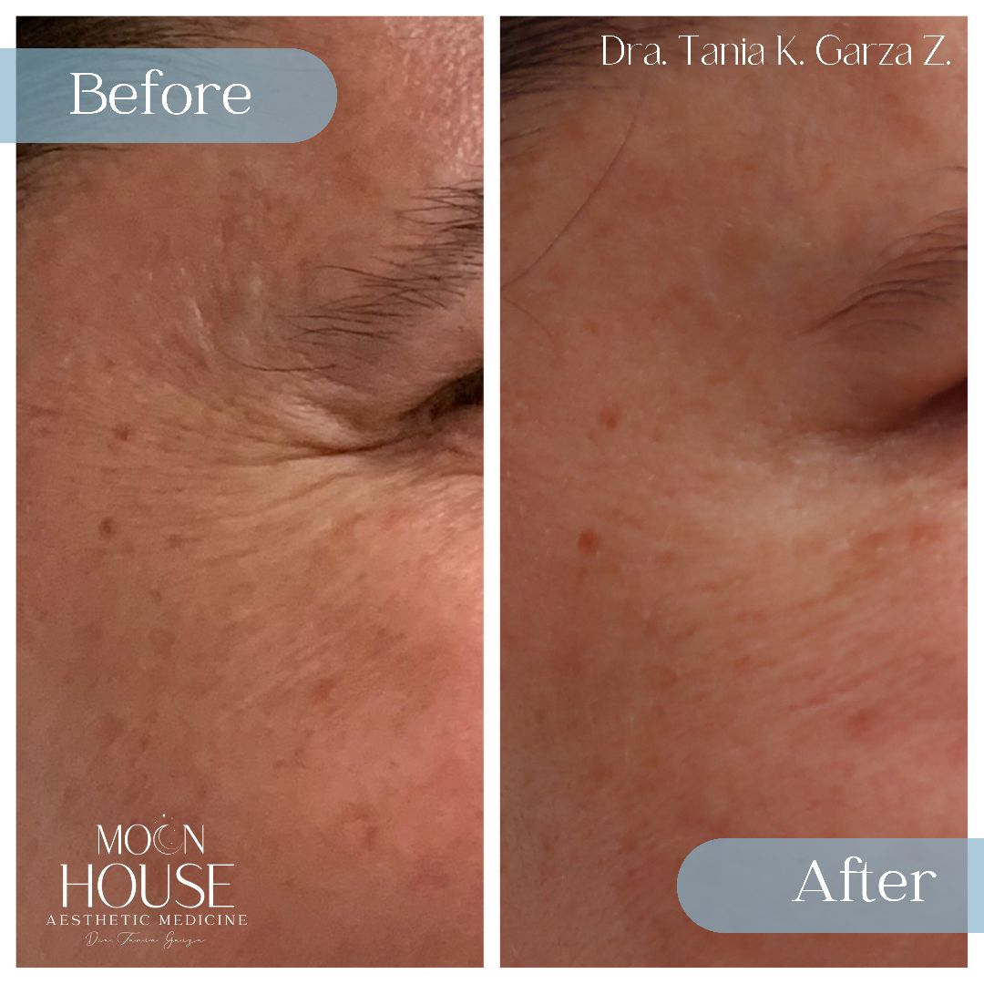 Tania Karine Garza Zepeda-8