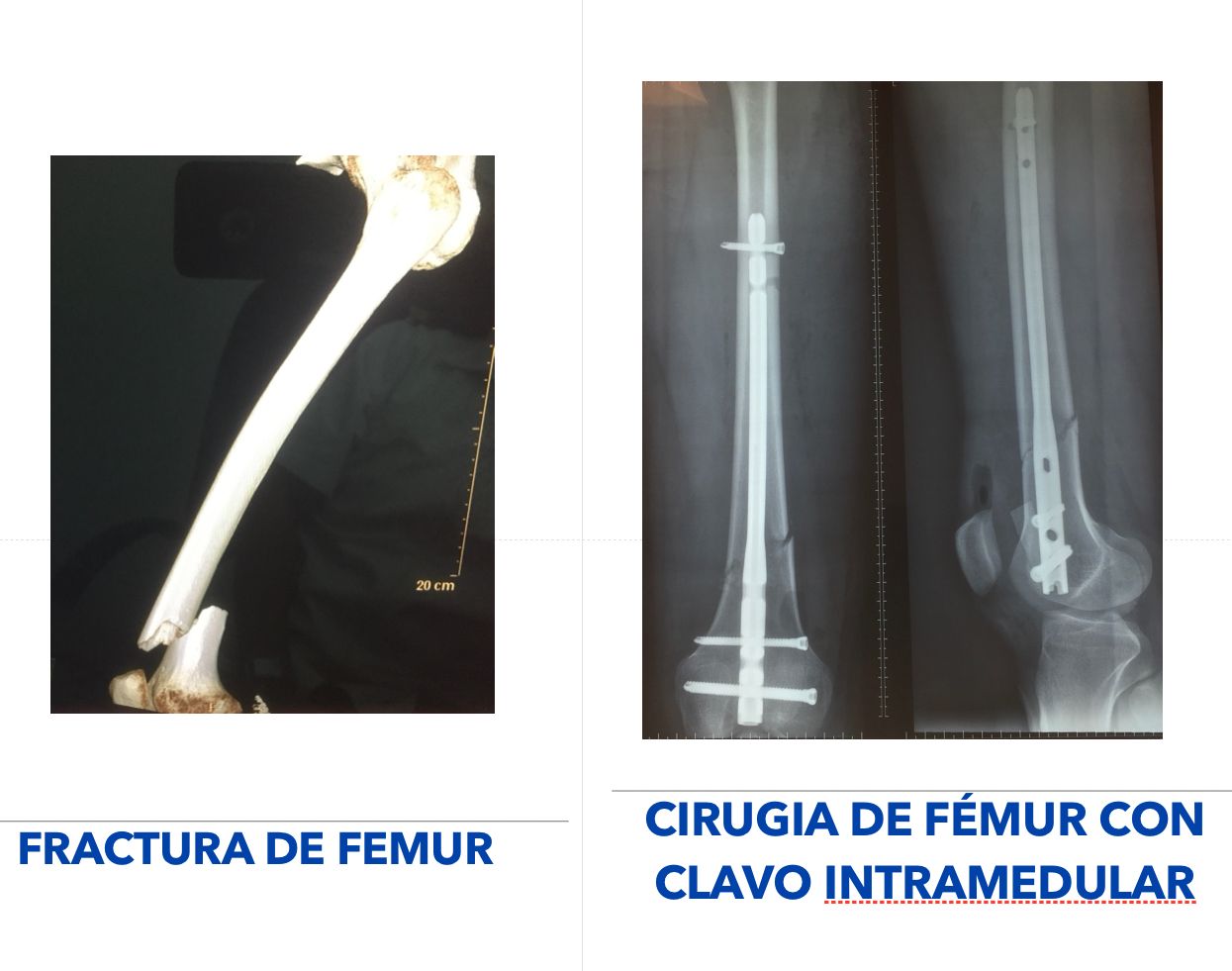 Pablo Mendoza Becerril-4