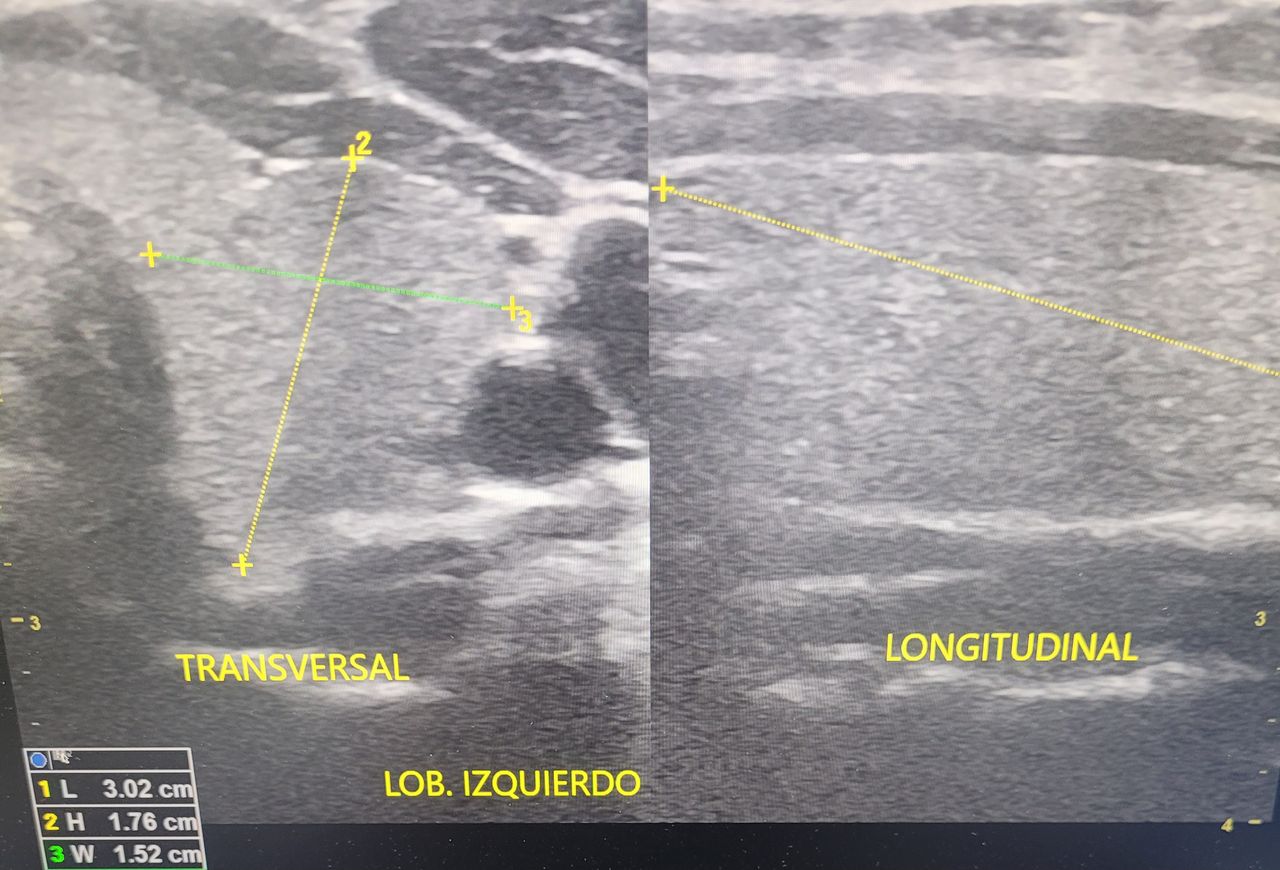 Einar Arik Nuñez Sanchez-9