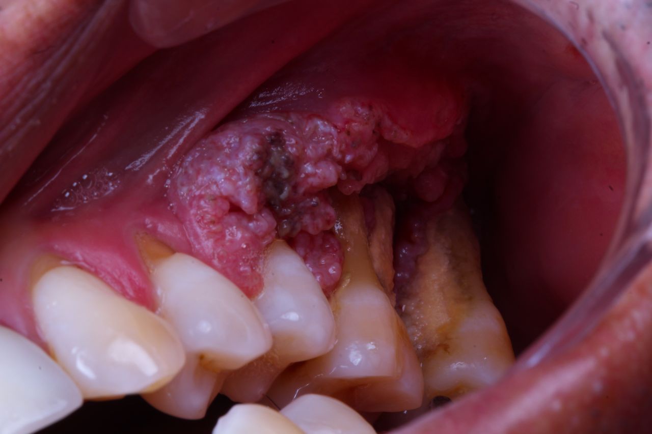 Hugo Enrique Aguilar Lamas-101