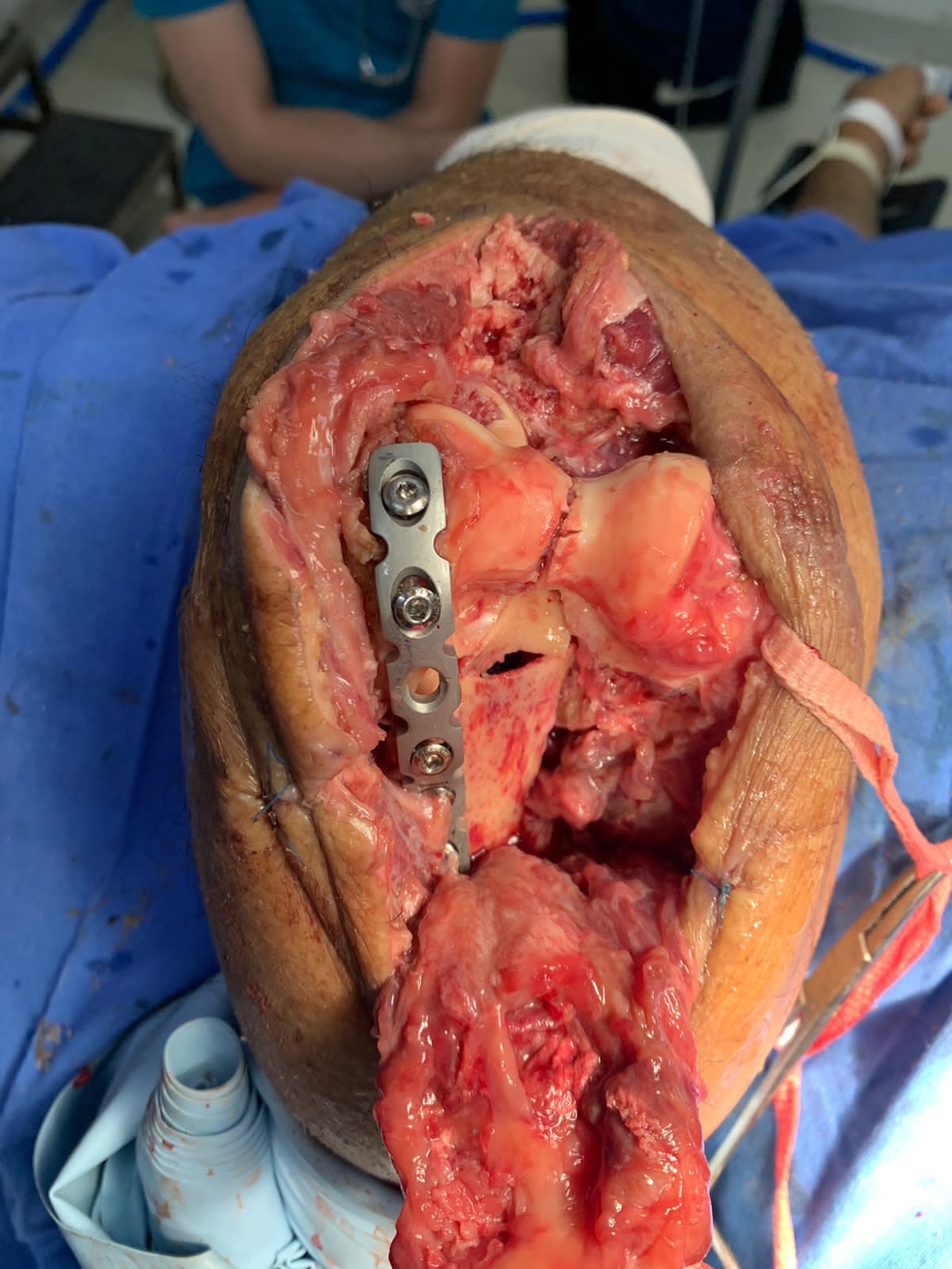 Francisco Sandoval Pérez-12