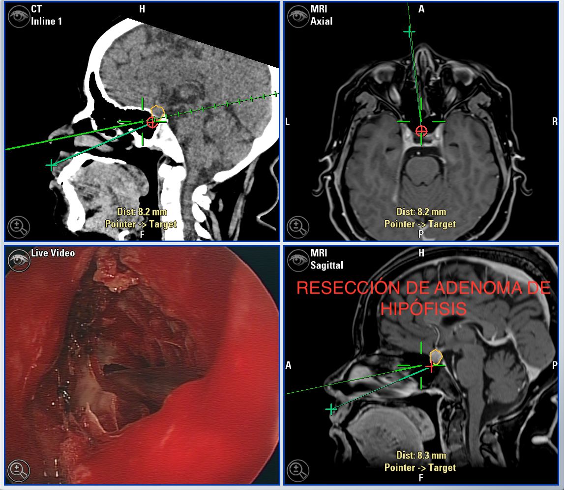 Enrique De Obieta Cruz-27