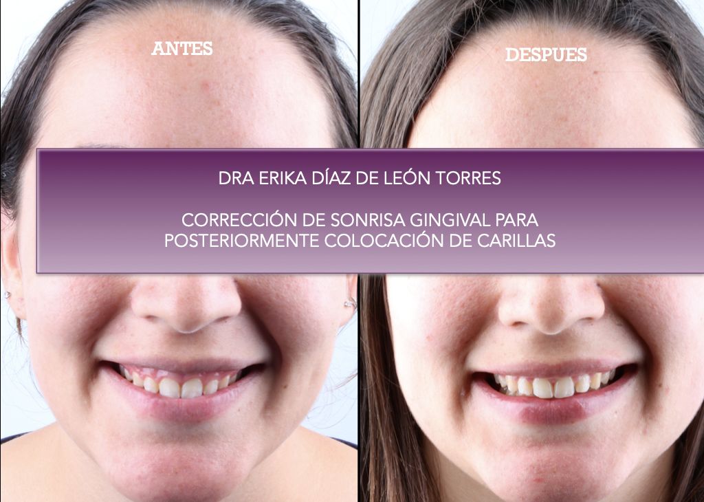 Erika Díaz De León Torres-17