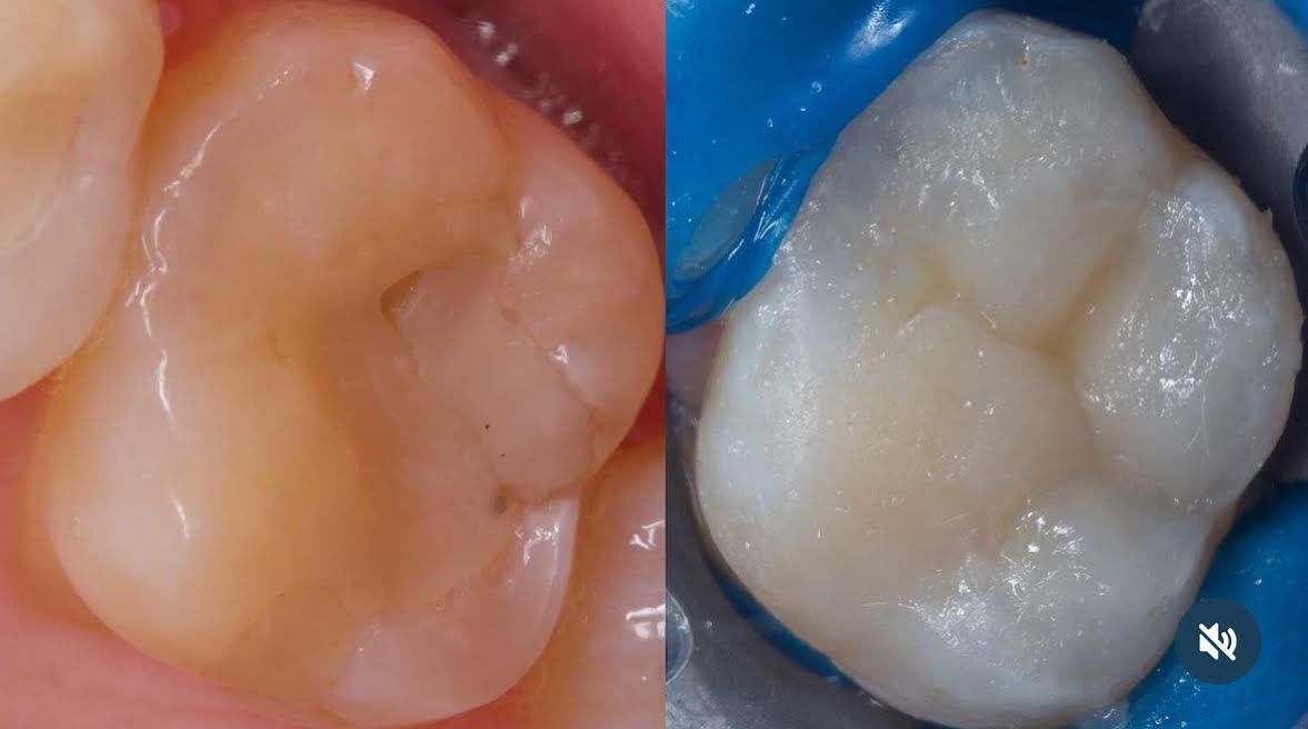 Yessica Ornelas Centeno-1