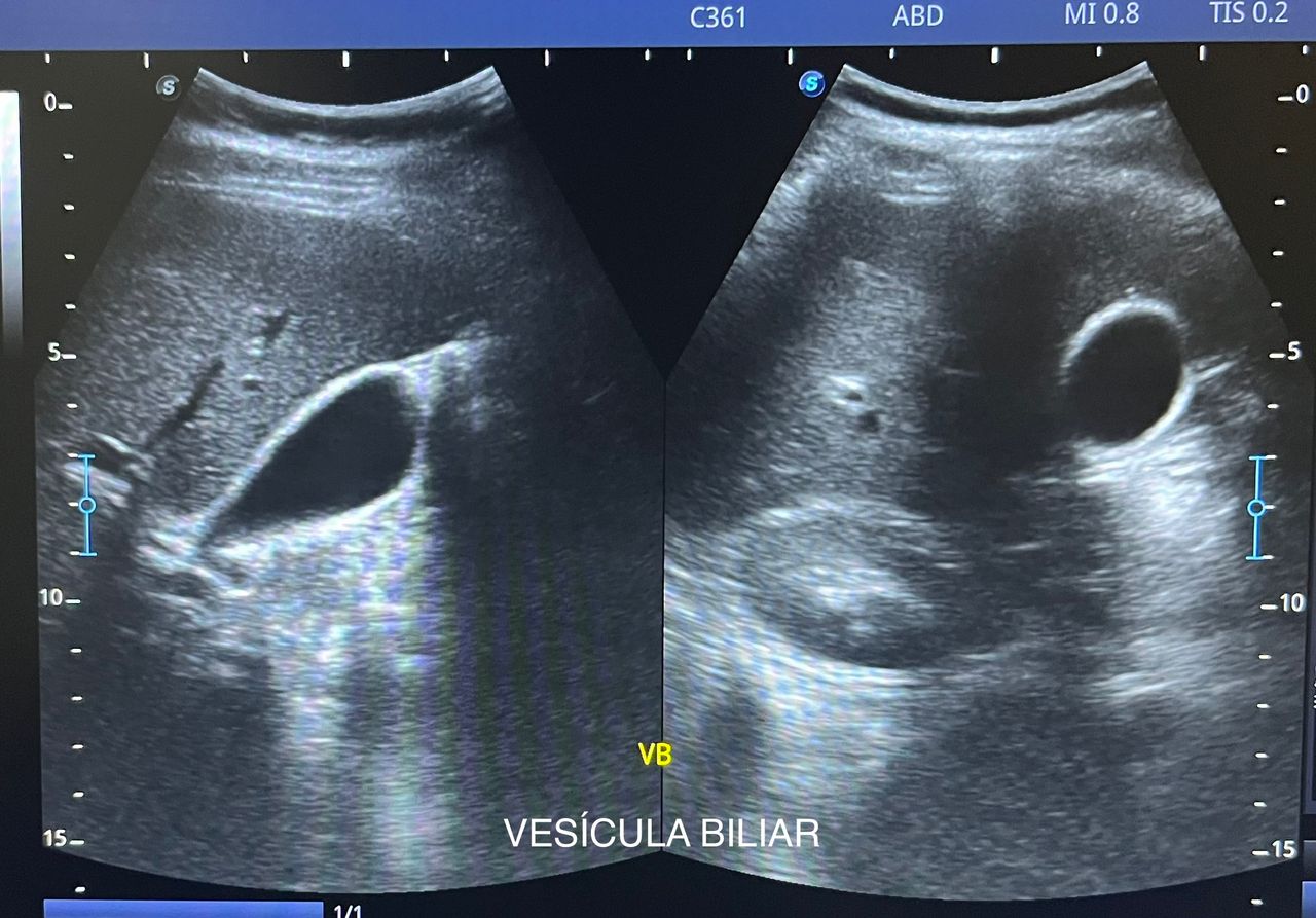 César Guerra Martínez-33