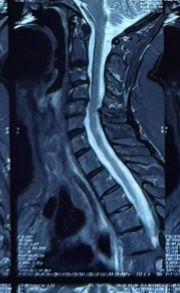 Alejandro Serrano Rubio-20