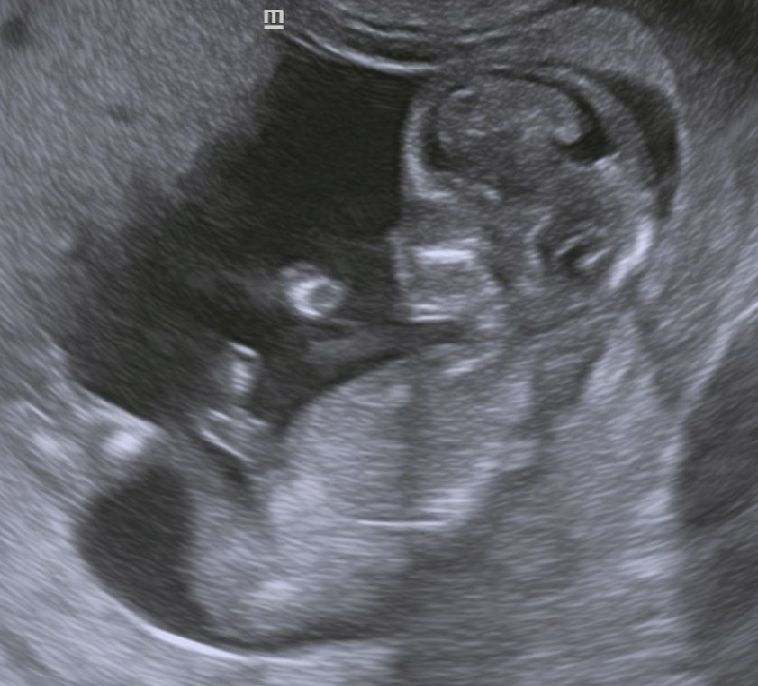 Mario López Franco-3