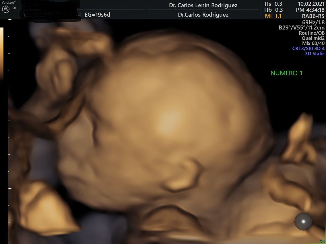 Carlos Lenin Rodriguez Mora-12