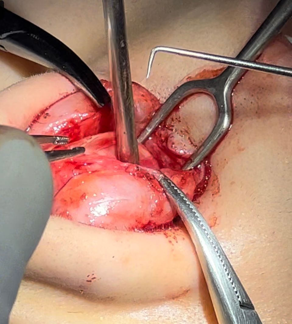 Juan Carlos Mendez Gutierrez-16