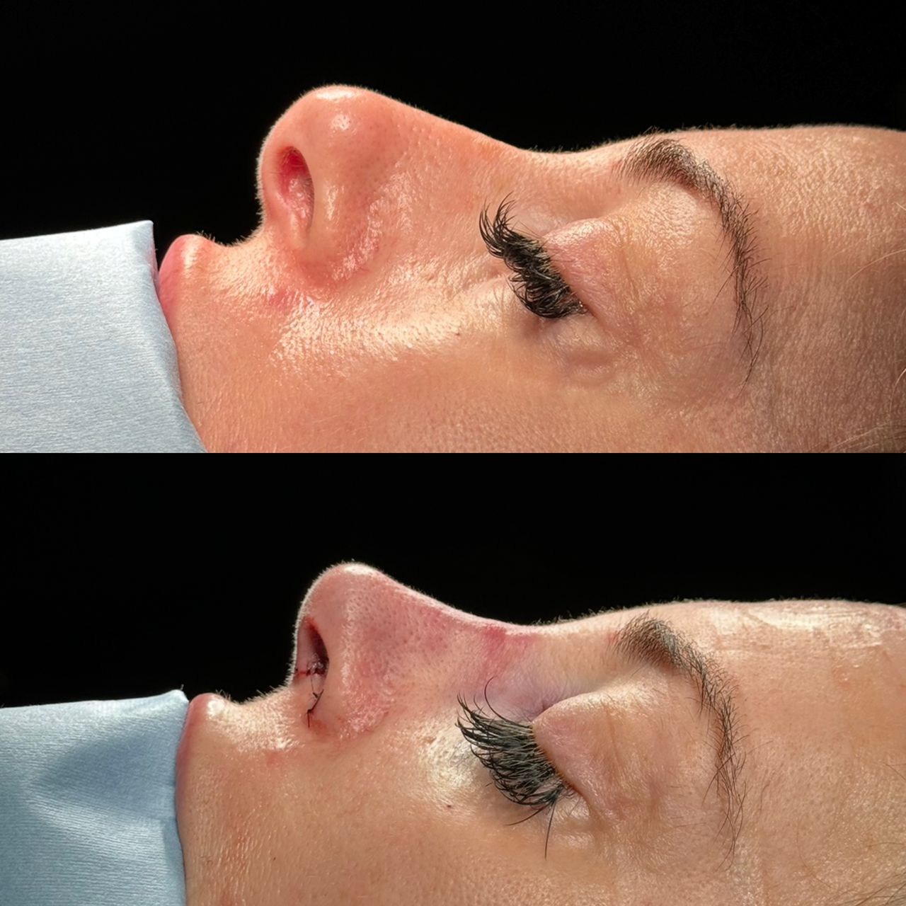 Angel Castro Urquizo-147