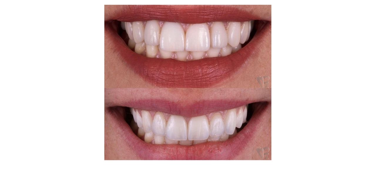 Ernesto Rojas Calderon-43