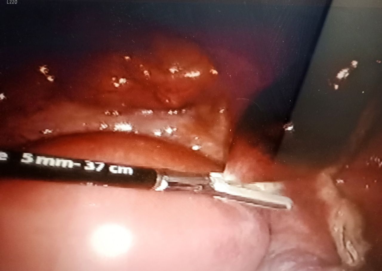 Manuel Pérez Morales-2