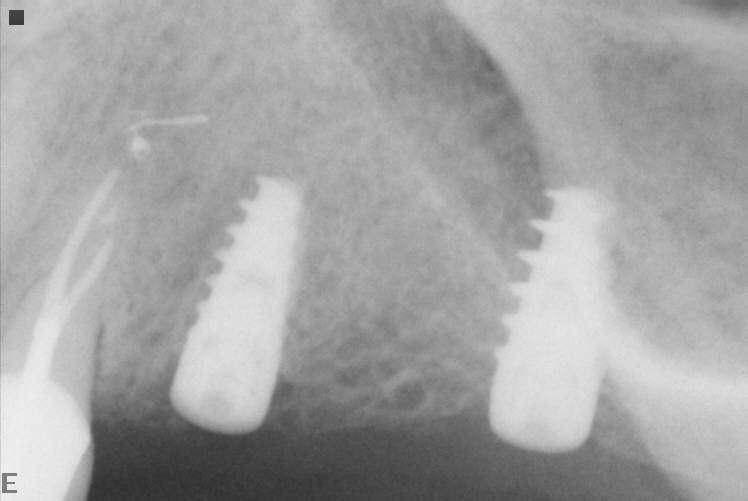 Josué Márquez Gómez-161