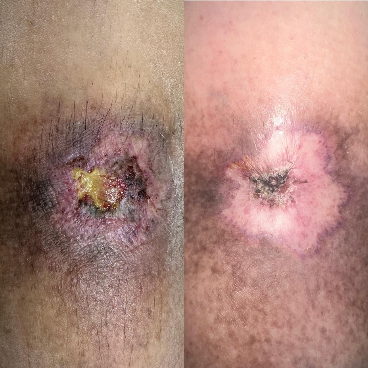 Jhonatan López González-40