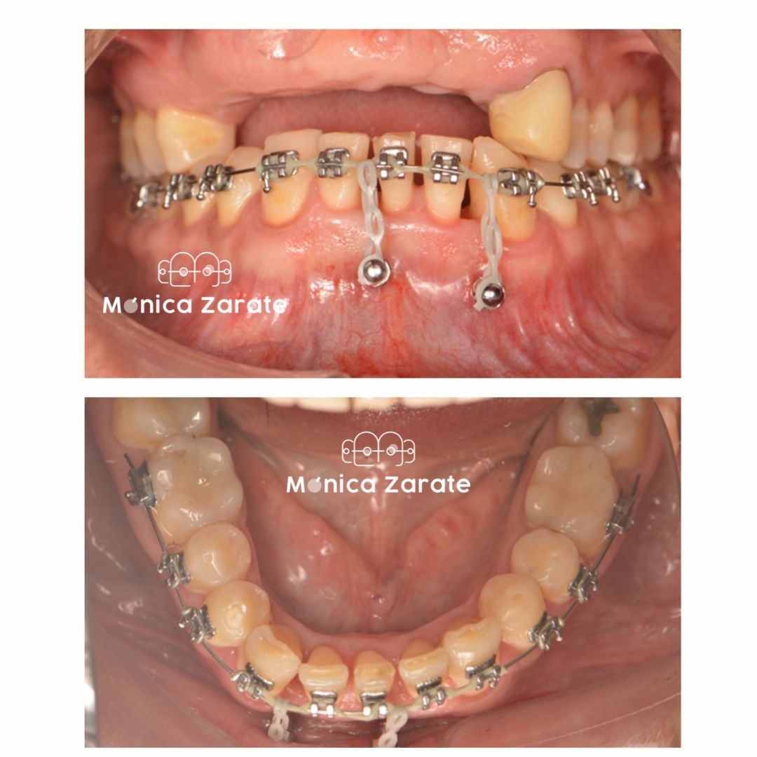 Mónica Isabel Zárate Pérez-14