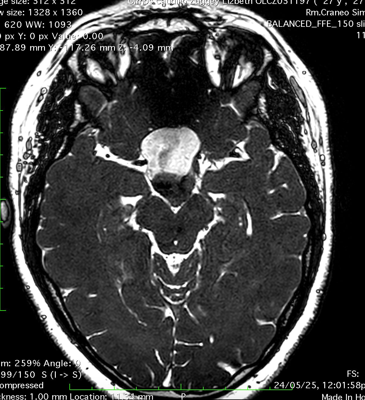 Marco Antonio Díaz Montoya-2