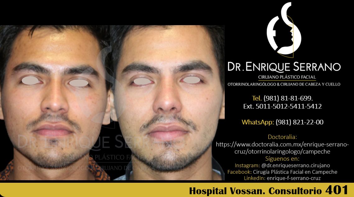 Enrique Serrano Cruz-96