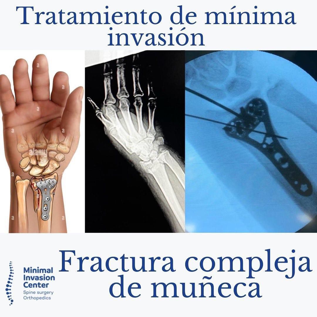 Omar Marroquín Herrera-23