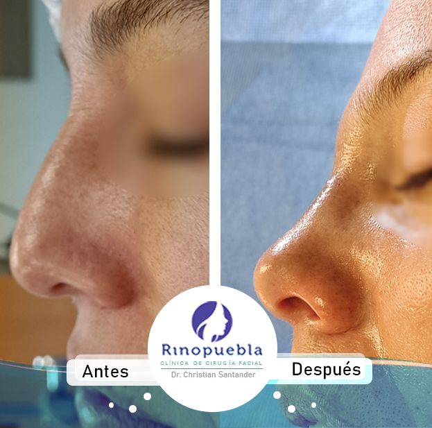 Christian Santander Becerra-26