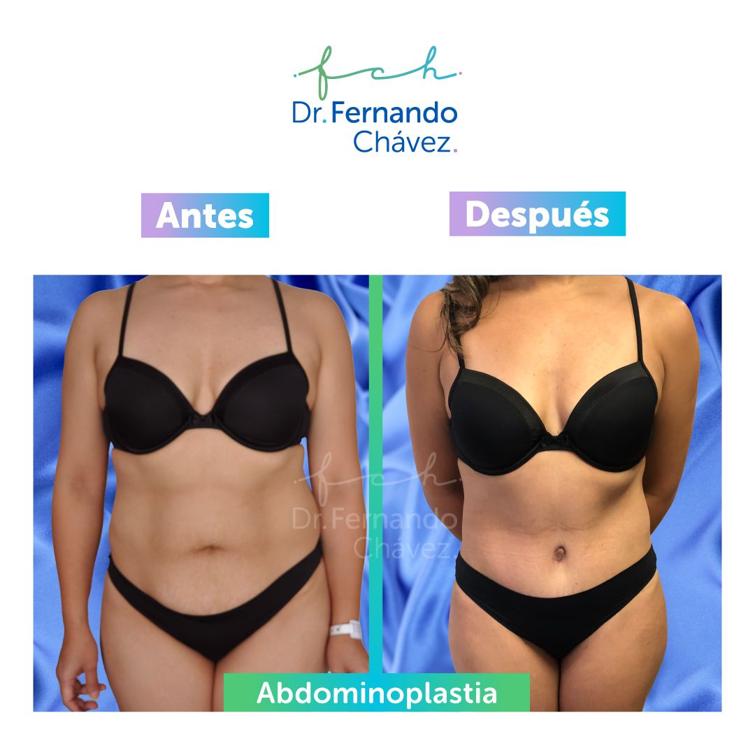 Fernando Chávez Osorio-11