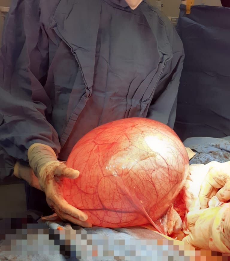 José Miguel Arano Acua-13