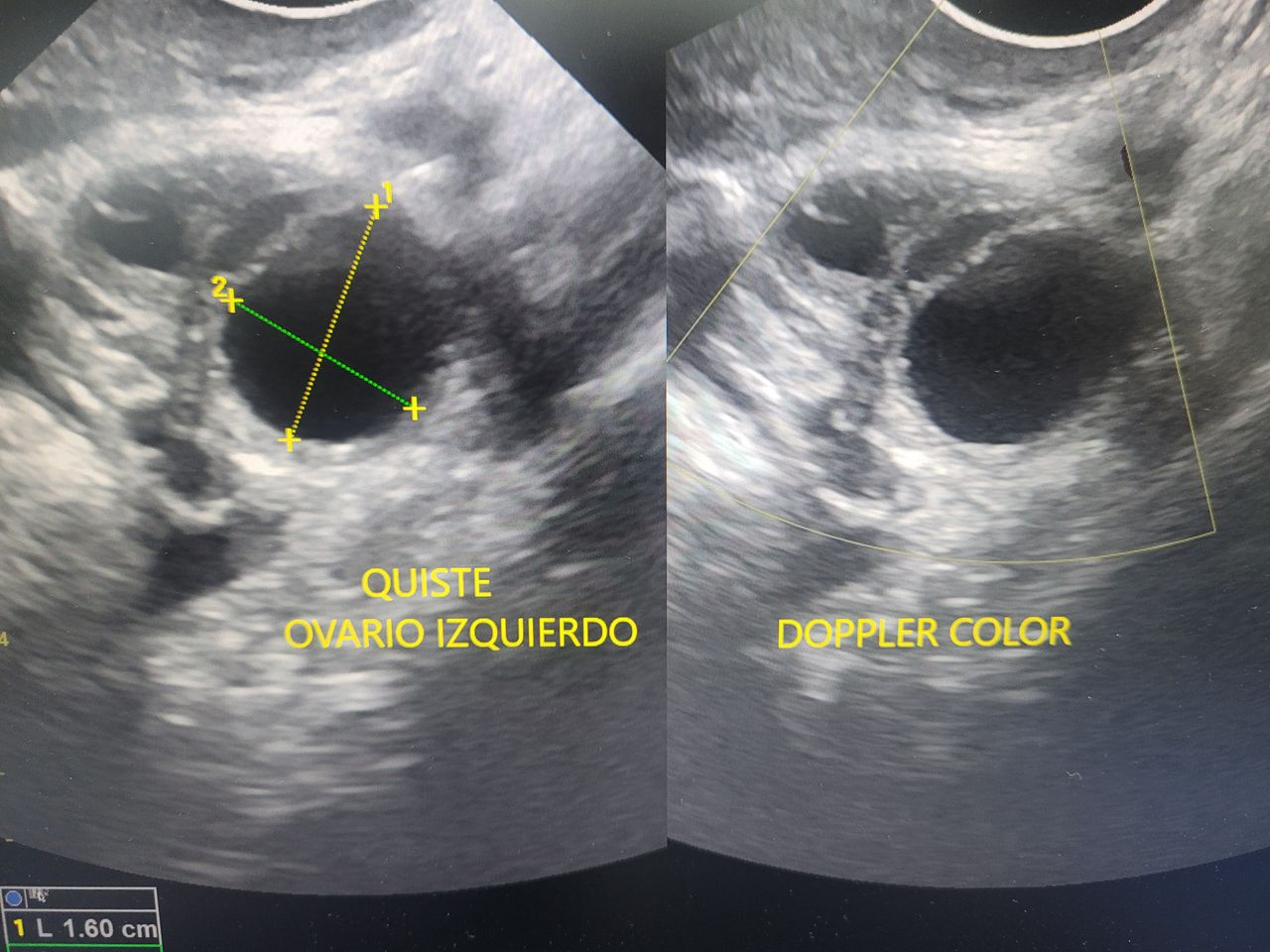 Einar Arik Nuñez Sanchez-11