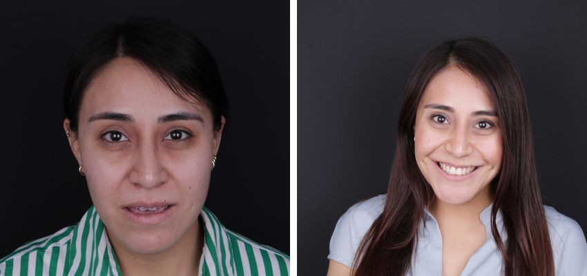 Federico Suastegui Carmona-11