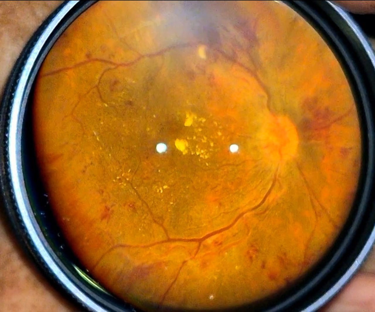 Dante Alan Guevara Villarreal-17