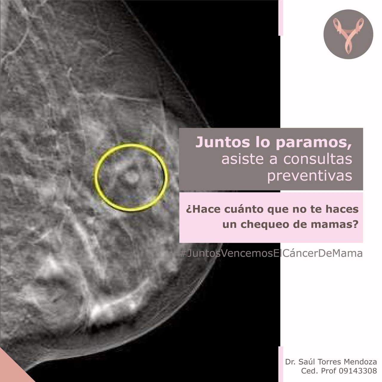 Rodolfo Saúl Torres Mendoza-6