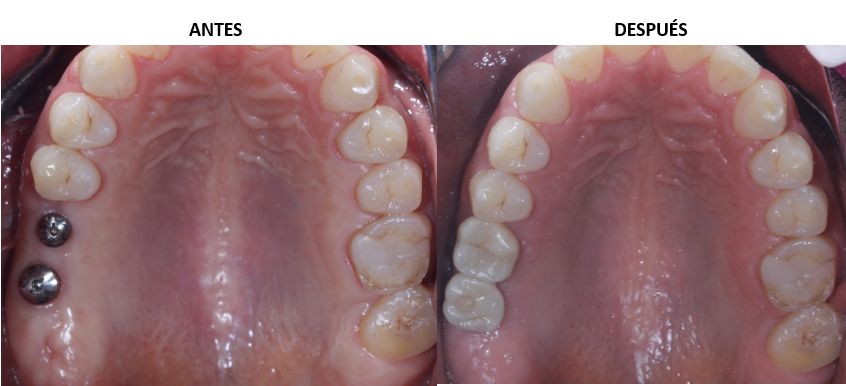 Ireri Rojas Bermúdez-6
