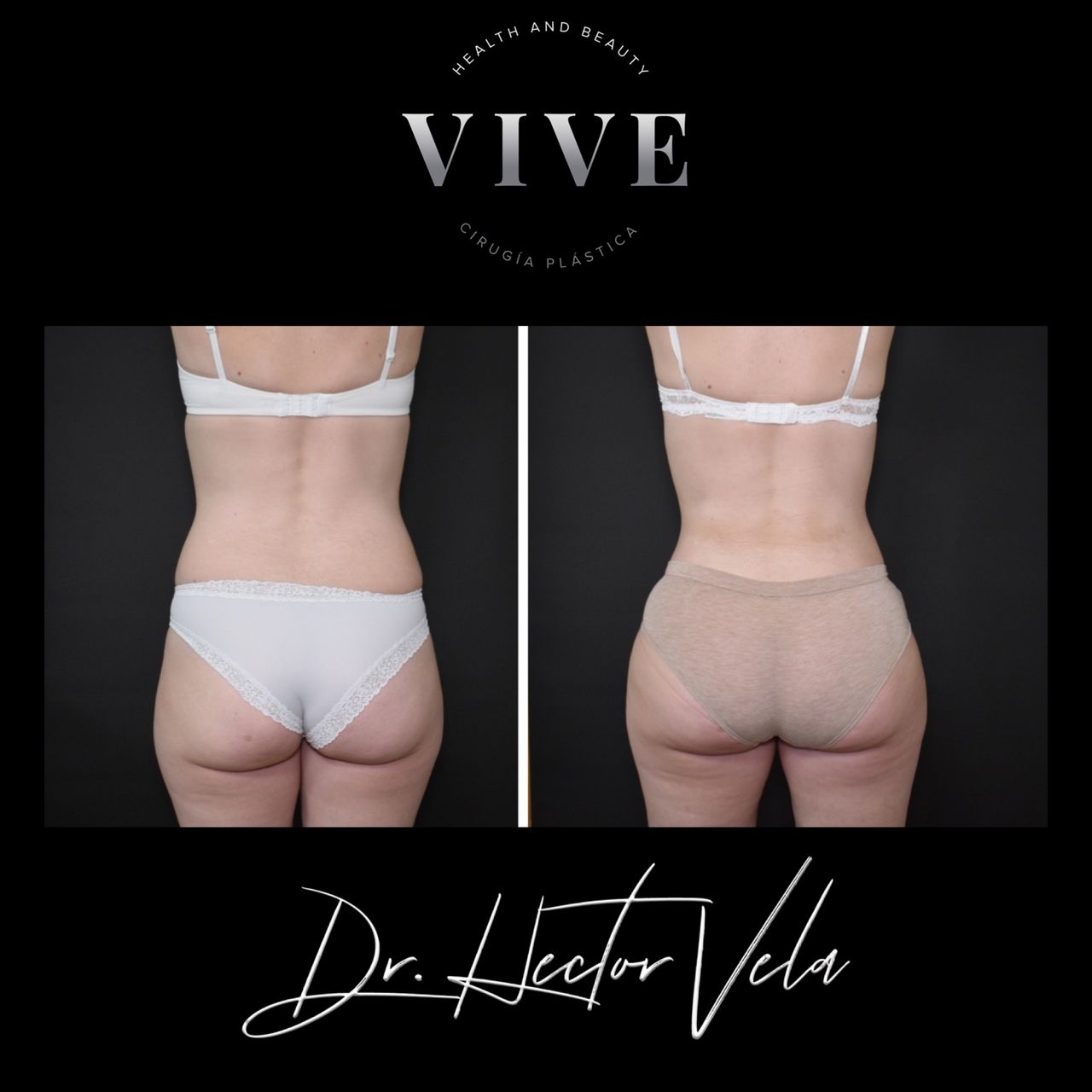 Héctor Eduardo Vela Cardona-139