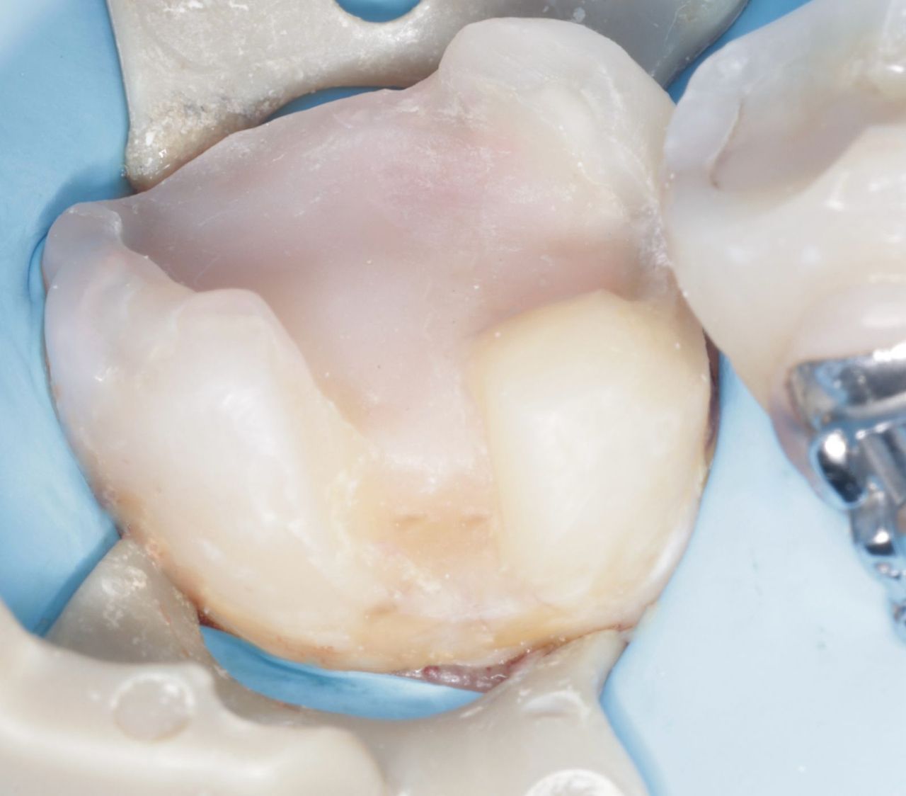 Fredy Alejandro Roblero Gónzalez-56