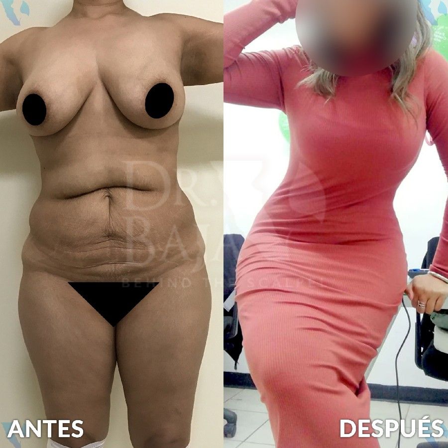 Renato Rodríguez Hirales-40