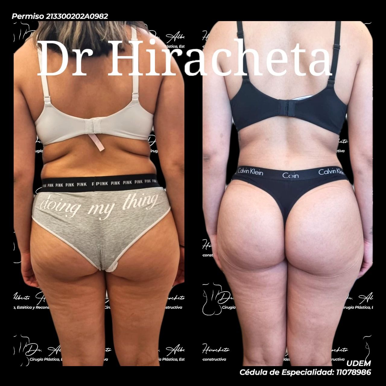 Alberto Hiracheta Torres-1