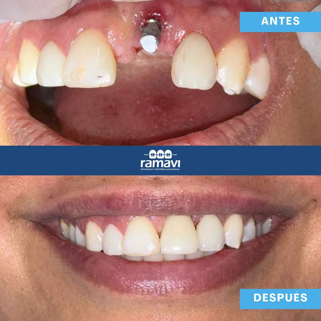 Ramon Mayorga Villeda-2